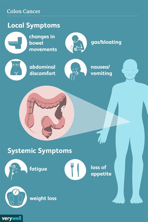 Signs and Symptoms of Colon Cancer