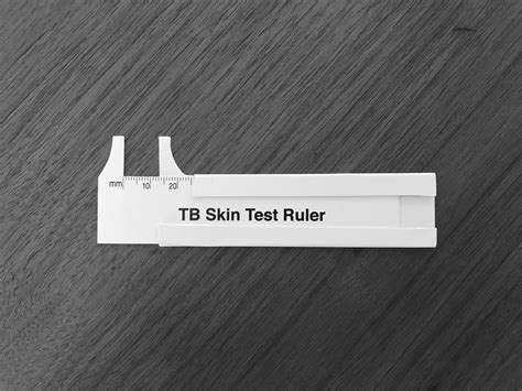 TB skin test ruler printable for accurate measurement