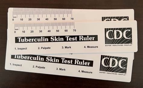 TB skin test ruler printable benefits