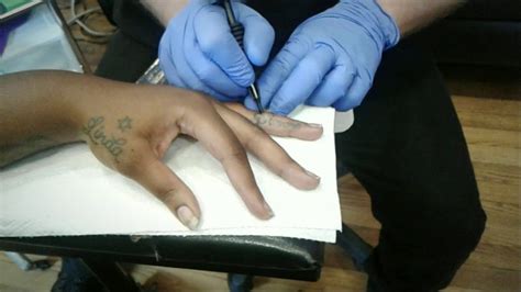 Tattoo Removal Athens