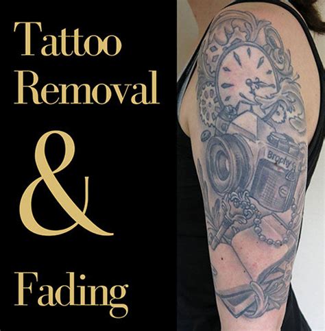 Tattoo Removal in Covington GA