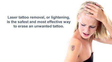 Tattoo Removal in Athens Ga