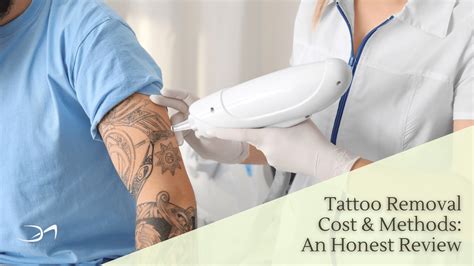 Tattoo removal techniques