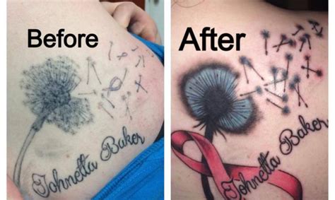 Tattoo Removal and Cover-Up