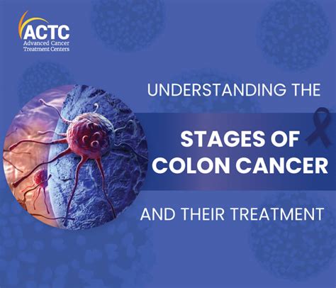 Understanding Colon Cancer