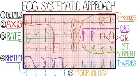 Understanding ECG Leads