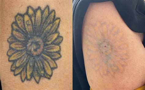 Understanding Tattoo Fading