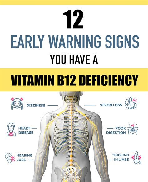 Vitamin B12 Deficiency And Sciatica