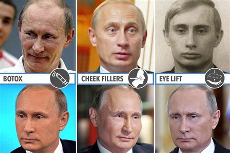 Vladimir Putin's physical appearance has changed over the years, sparking concerns about his health