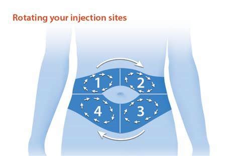 Abdomen Injection Site