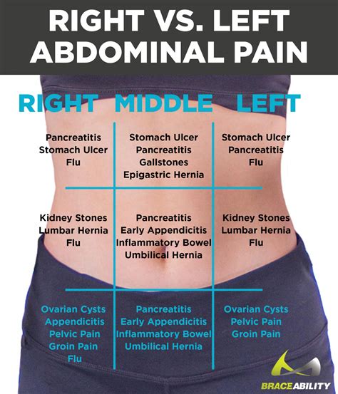 Abdomen Pain Image 1