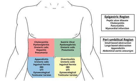 Abdomen Pain Diagnosis