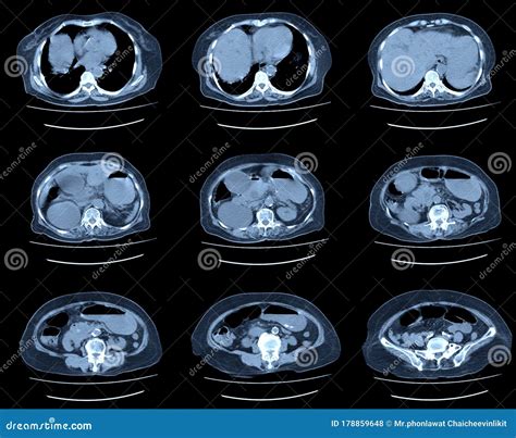 Abdomen scan image