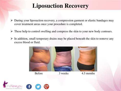 Abdominal Lipo Benefits