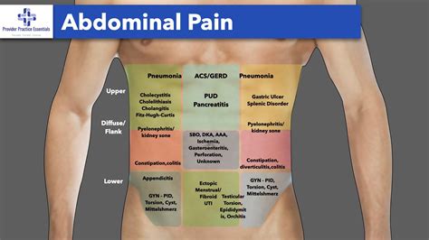 Abdominal pain symptoms