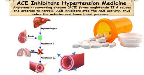 ACE Inhibitors for Hypertension