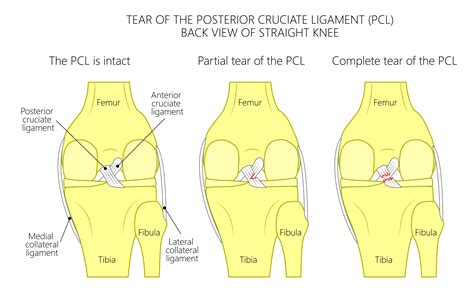 Description of Image 1