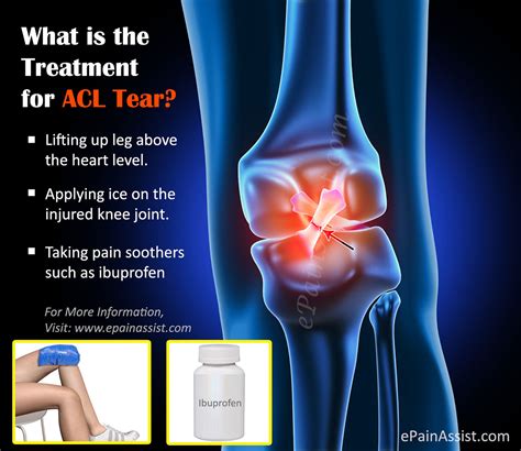 Acl injury treatment