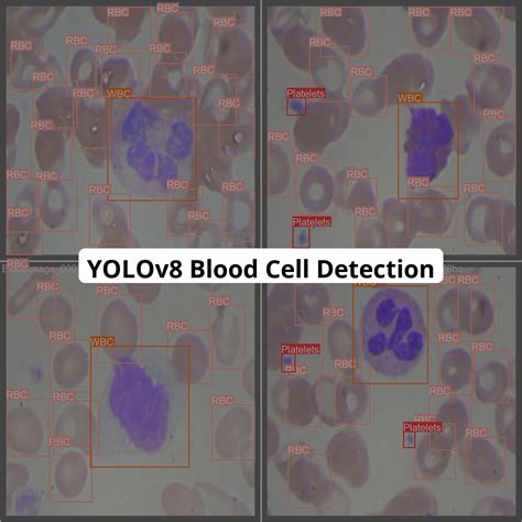 Active Cell Detection in Sheets