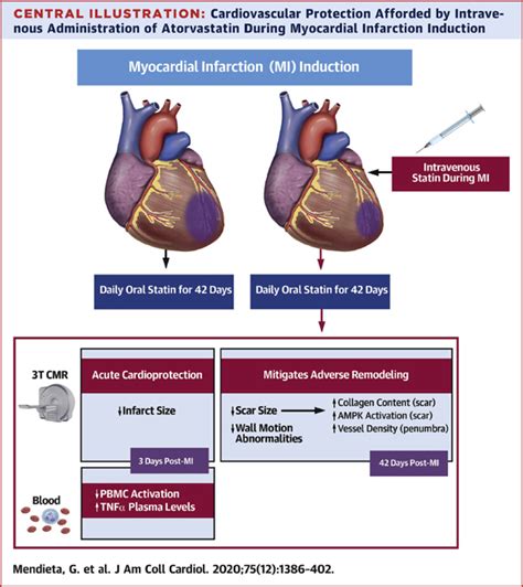 Administration of Myocardial Infarction