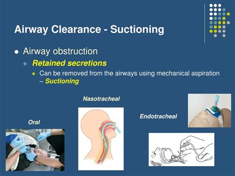 Airway management clearance