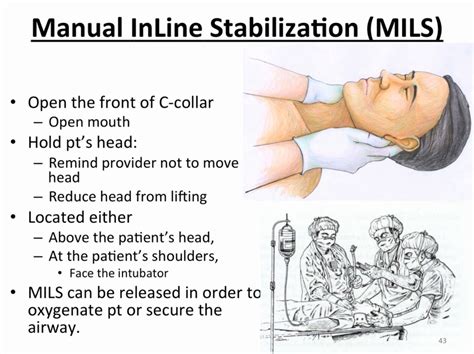 Airway management stabilization