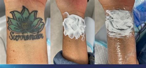 Alternatives to tattoo cream numbing relief