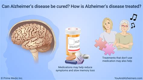 Alzheimer's treatment