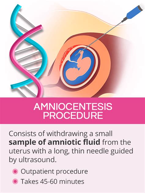 Amniocentesis Procedure Steps