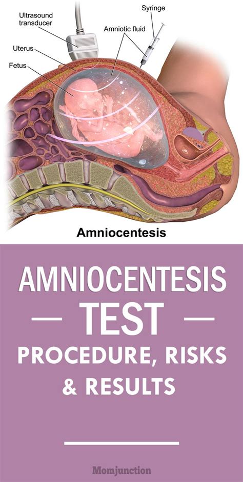 Amniocentesis Results and Follow-Up