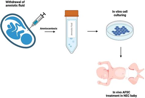 Amniotic Fluid Withdrawal