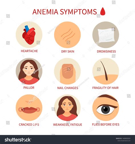 Anemia Symptoms