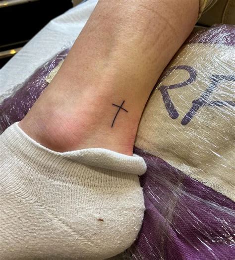 Ankle Cross Tattoo Removal