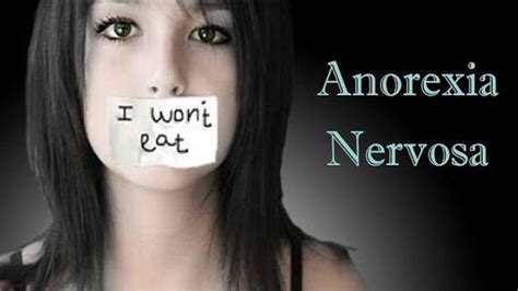 Anorexia Nervosa Facts