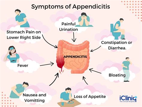 Appendicitis treatment