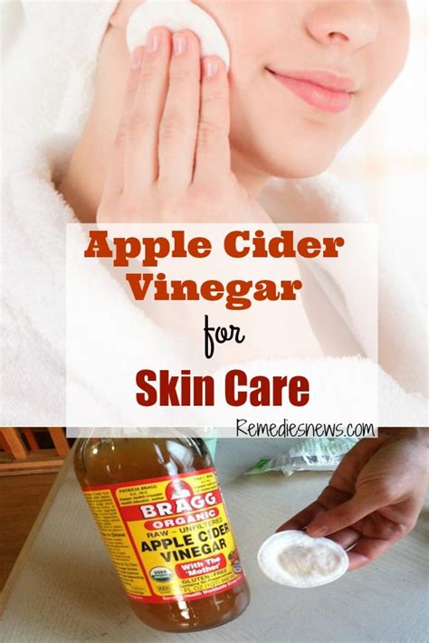 Apple Cider Vinegar for Skin