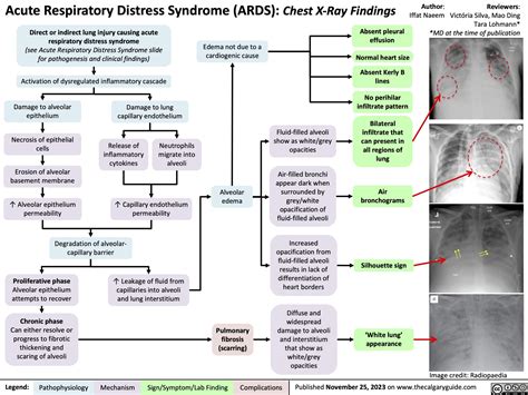 ARDS Research