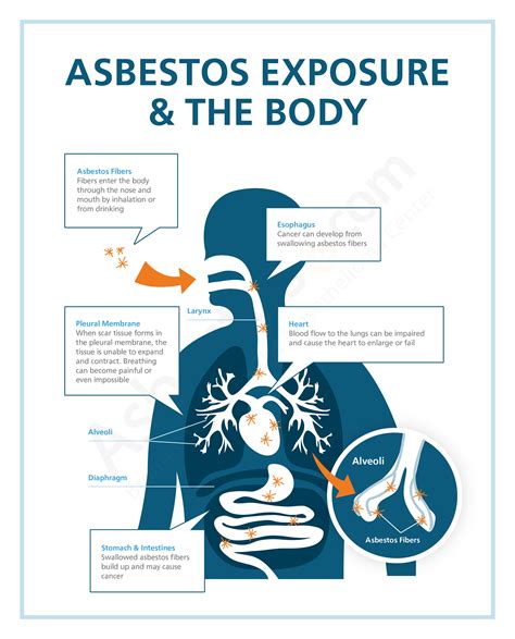 Asbestos exposure in the Navy