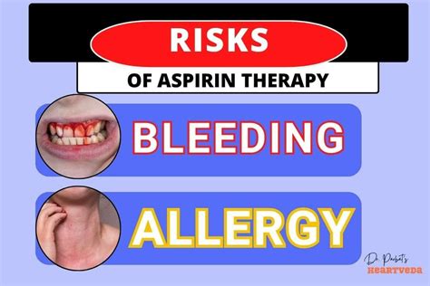 Aspirin Therapy Risks