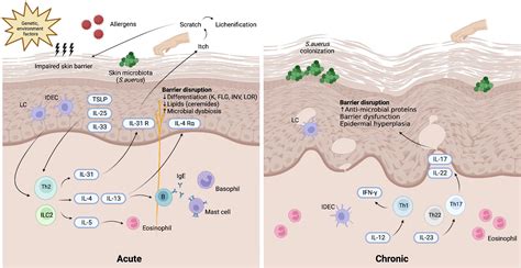 atopy introduction