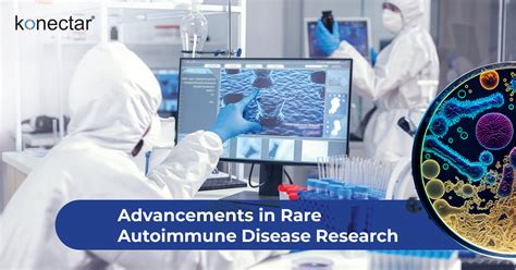 Autoimmune diseases research and development