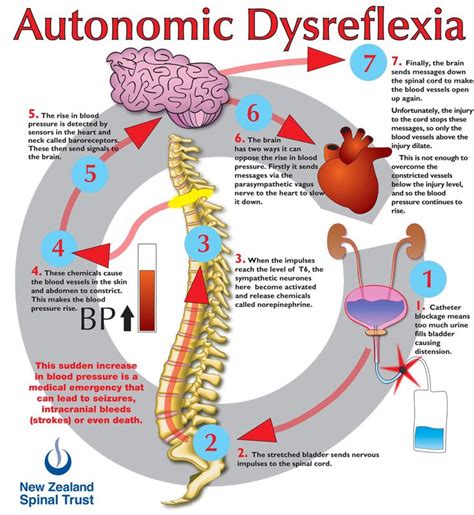 Autonomic Dysreflexia Awareness