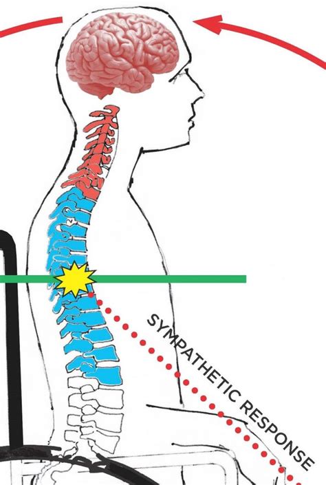 Autonomic Dysreflexia Research