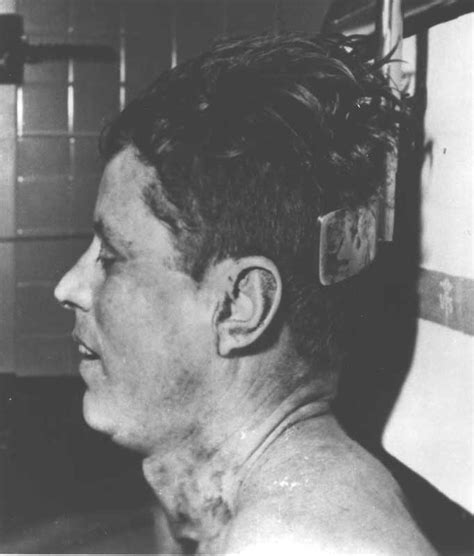 Description of Autopsy Photo 4