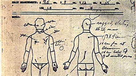 Description of Autopsy Photo 9