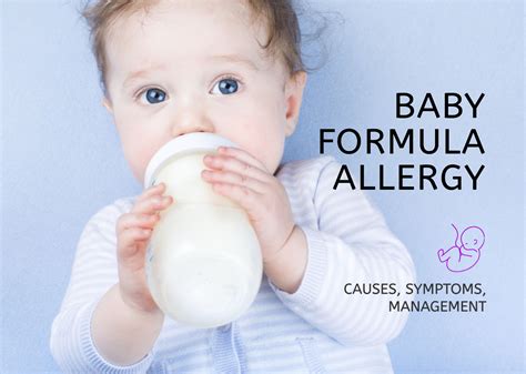 Baby Formula Allergies