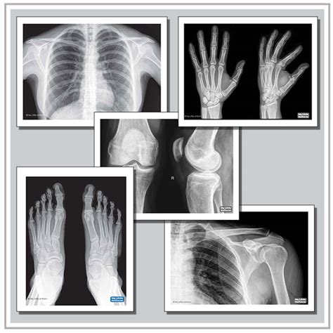 Bee X-Ray Printable