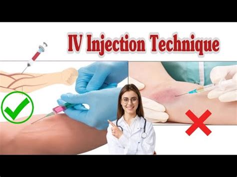 Benefits of Proper Injection Technique