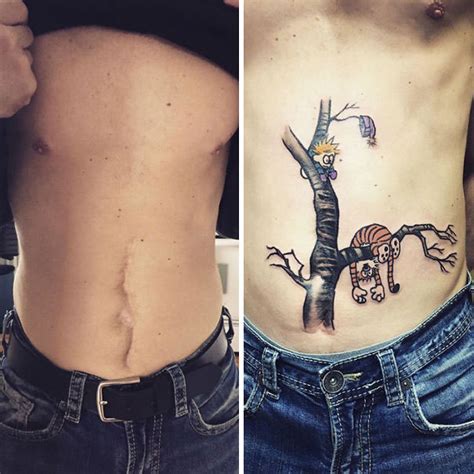 Best scar tattoo cover up