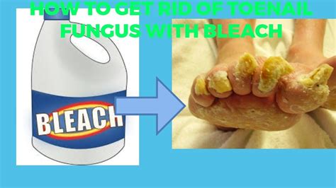 Bleach effectiveness against fungus